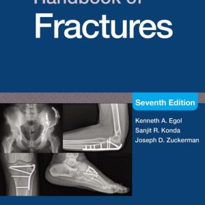 handbook of fracture 2026